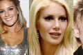 Heidi Montag’s shocking new surgery. Reveals new face.