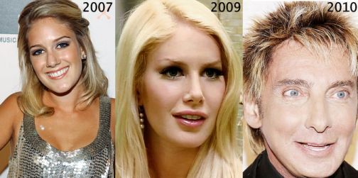 Heidi Montag’s shocking new surgery. Reveals new face.